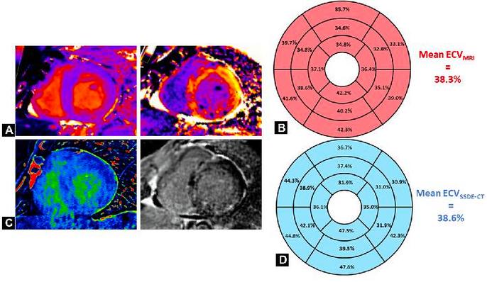 uni radiology,Understanding the World of Uni Radiology